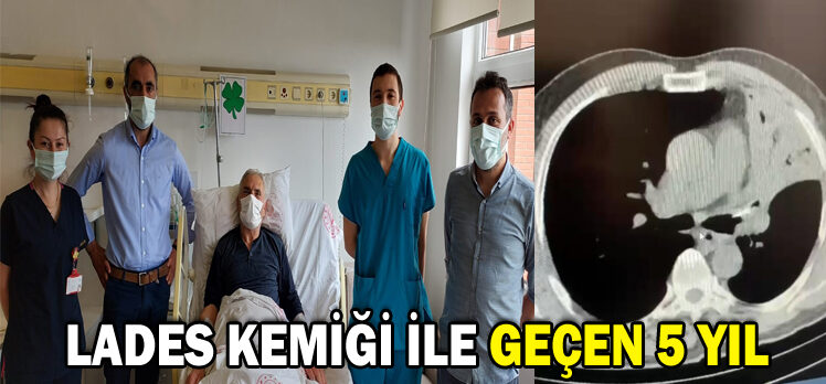 LADES KEMİĞİ İLE GEÇEN 5 YIL